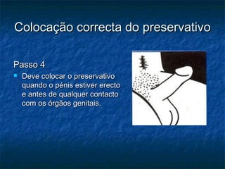 Colocação correcta do preservativoColocação correcta do preservativo
Passo 4Passo 4
 Deve colocar o preservativoDeve colocar o preservativo
quando o pénis estiver erectoquando o pénis estiver erecto
e antes de qualquer contactoe antes de qualquer contacto
com os órgãos genitais.com os órgãos genitais.
 