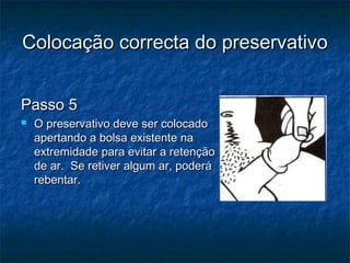Colocação correcta do preservativoColocação correcta do preservativo
Passo 5Passo 5
 O preservativo deve ser colocadoO preservativo deve ser colocado
apertando a bolsa existente naapertando a bolsa existente na
extremidade para evitar a retençãoextremidade para evitar a retenção
de ar. Se retiver algum ar, poderáde ar. Se retiver algum ar, poderá
rebentar.rebentar.
 