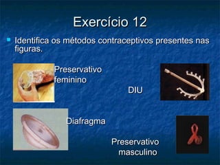 Exercício 12Exercício 12
 Identifica os métodos contraceptivos presentes nasIdentifica os métodos contraceptivos presentes nas
figuras.figuras.
PreservativoPreservativo
femininofeminino
DIUDIU
DiafragmaDiafragma
PreservativoPreservativo
masculinomasculino
 
