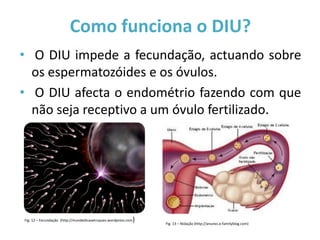 Como funciona o DIU?
• O DIU impede a fecundação, actuando sobre
  os espermatozóides e os óvulos.
• O DIU afecta o endométrio fazendo com que
  não seja receptivo a um óvulo fertilizado.




Fig. 12 – Fecundação (http://mundedicasetruques.wordpress.com   )   Fig. 13 – Nidação (http://anunes.e-familyblog.com)
 