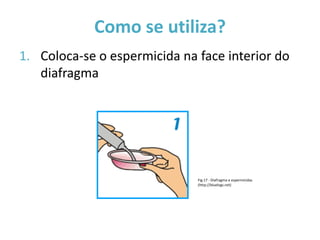 Como se utiliza?
1. Coloca-se o espermicida na face interior do
   diafragma




                              Fig.17 - Diafragma e espermicidas
                              (http://bluelogs.net)
 