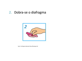 2. Dobra-se o diafragma




     Fig.18 - diafragma dobrado (http://bluelogs.net)
 