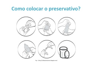 Como colocar o preservativo?




         Fig – 3 http://12desportolumiar.blogspot.com/
 