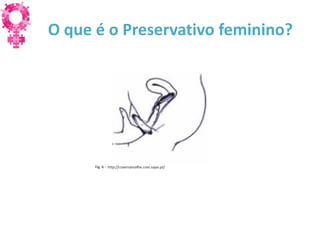 O que é o Preservativo feminino?




      Fig. 6 -
 