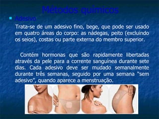 Métodos químicos Adesivo  Trata-se de um adesivo fino, bege, que pode ser usado em quatro áreas do corpo: as nádegas, peito (excluindo os seios), costas ou parte externa do membro superior. Contém hormonas que são rapidamente libertadas através da pele para a corrente sanguínea durante sete dias. Cada adesivo deve ser mudado semanalmente durante três semanas, seguido por uma semana “sem adesivo”, quando aparece a menstruação. 