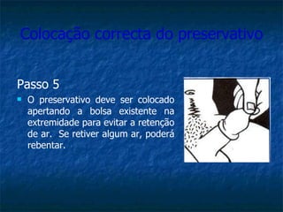 Colocação correcta do preservativo Passo 5 O preservativo deve ser colocado apertando a bolsa existente na extremidade para evitar a retenção de ar.  Se retiver algum ar, poderá rebentar. 