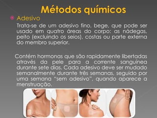 Adesivo  Trata-se de um adesivo fino, bege, que pode ser usado em quatro áreas do corpo: as nádegas, peito (excluindo os seios), costas ou parte externa do membro superior. Contém hormonas que são rapidamente libertadas através da pele para a corrente sanguínea durante sete dias. Cada adesivo deve ser mudado semanalmente durante três semanas, seguido por uma semana “sem adesivo”, quando aparece a menstruação. 