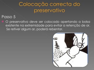 Passo 5 O preservativo deve ser colocado apertando a bolsa existente na extremidade para evitar a retenção de ar.  Se retiver algum ar, poderá rebentar. 