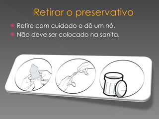 Retire com cuidado e dê um nó.  Não deve ser colocado na sanita. 