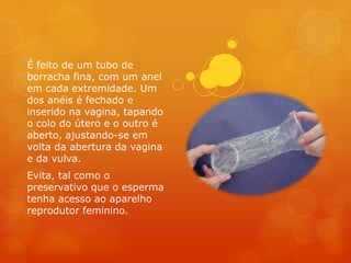 É feito de um tubo de
borracha fina, com um anel
em cada extremidade. Um
dos anéis é fechado e
inserido na vagina, tapando
o colo do útero e o outro é
aberto, ajustando-se em
volta da abertura da vagina
e da vulva.
Evita, tal como o
preservativo que o esperma
tenha acesso ao aparelho
reprodutor feminino.
 