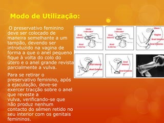 Modo de Utilização:
 O preservativo feminino
deve ser colocado de
maneira semelhante a um
tampão, devendo ser
introduzido na vagina de
forma a que o anel pequeno
fique à volta do colo do
útero e o anel grande revista
parcialmente a vulva.
Para se retirar o
preservativo feminino, após
a ejaculação, deve-se
exercer tracção sobre o anel
que reveste a
vulva, verificando-se que
não produz nenhum
contacto do sémen retido no
seu interior com os genitais
femininos.
 