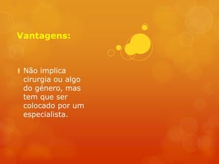 Vantagens:



 Não implica
  cirurgia ou algo
  do género, mas
  tem que ser
  colocado por um
  especialista.
 