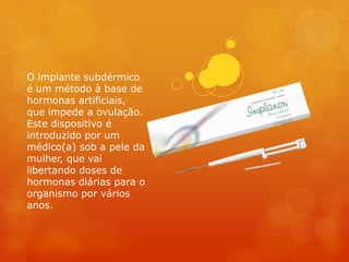 O implante subdérmico
é um método à base de
hormonas artificiais,
que impede a ovulação.
Este dispositivo é
introduzido por um
médico(a) sob a pele da
mulher, que vai
libertando doses de
hormonas diárias para o
organismo por vários
anos.
 