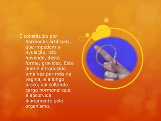 É constituído por
   hormonas artificiais,
   que impedem a
   ovulação, não
   havendo, desta
   forma, gravidez. Este
   anel é introduzido
   uma vez por mês na
   vagina, e a longo
   prazo, vai soltando
   carga hormonal que
   é absorvida
   diariamente pelo
   organismo.
 