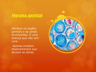 Herpes genital


Afectam os órgãos
genitais e as zonas
envolventes. É uma
doença que não tem
cura.
 Apenas existem
medicamentos que
aliviam as dores.
 