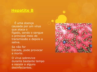Hepatite B


   É uma doença
causada por um vírus
que ataca o
fígado, sendo o sangue
o principal meio de
transmissão e depois a
saliva.
Se não for
tratada, pode provocar
a morte.
O vírus sobrevive
durante bastante tempo
e resiste a alguns
desinfectantes.
 