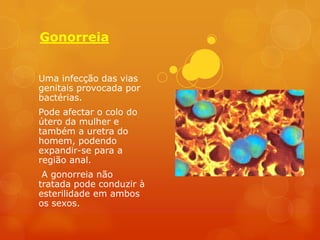 Gonorreia


Uma infecção das vias
genitais provocada por
bactérias.
Pode afectar o colo do
útero da mulher e
também a uretra do
homem, podendo
expandir-se para a
região anal.
 A gonorreia não
tratada pode conduzir à
esterilidade em ambos
os sexos.
 