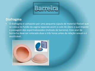 Diafragma 
• O diafragma é composto por uma pequena cúpula de material flexível que 
se coloca no fundo da vagina tapando assim o colo do útero o que impede 
a passagem dos espermatozoides (método de barreira). Este anel de 
borracha deve ser colocado duas a três horas antes da relação sexual e é 
reutilizável. 
 