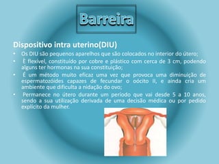 Dispositivo intra uterino(DIU) 
• Os DIU são pequenos aparelhos que são colocados no interior do útero; 
• È flexível, constituído por cobre e plástico com cerca de 3 cm, podendo 
alguns ter hormonas na sua constituição; 
• É um método muito eficaz uma vez que provoca uma diminuição de 
espermatozóides capazes de fecundar o oócito II, e ainda cria um 
ambiente que dificulta a nidação do ovo; 
• Permanece no útero durante um período que vai desde 5 a 10 anos, 
sendo a sua utilização derivada de uma decisão médica ou por pedido 
explícito da mulher. 
 