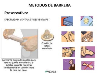 METODOS DE BARRERA
Preservativo:
EFECTIVIDAD, VENTAJAS Y DESVENTAJAS   :
 