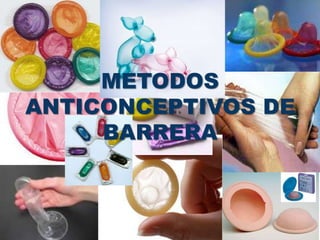 METODOS
ANTICONCEPTIVOS DE
BARRERA
 