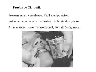 Prueba de Cloroetilo
• Frecuentemente empleado. Fácil manipulación.
• Pulverizar con generosidad sobre una bolita de algodón.
• Aplicar sobre tercio medio coronal, durante 5 segundos.
 