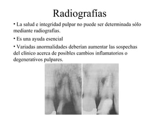 Radiografías
• La salud e integridad pulpar no puede ser determinada sólo
mediante radiografías.
• Es una ayuda esencial
• Variadas anormalidades deberían aumentar las sospechas
del clínico acerca de posibles cambios inflamatorios o
degenerativos pulpares.
 