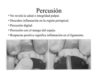 Percusión
• No revela la salud o integridad pulpar.
• Descubre inflamación en la región periapical.
• Percusión digital.
• Percusión con el mango del espejo.
• Respuesta positiva significa inflamación en el ligamento.
 