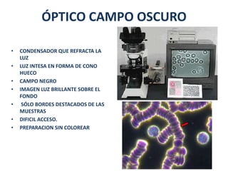ÓPTICO CAMPO OSCURO

•   CONDENSADOR QUE REFRACTA LA
    LUZ
•   LUZ INTESA EN FORMA DE CONO
    HUECO
•   CAMPO NEGRO
•   IMAGEN LUZ BRILLANTE SOBRE EL
    FONDO
•    SÓLO BORDES DESTACADOS DE LAS
    MUESTRAS
•   DIFICIL ACCESO.
•   PREPARACION SIN COLOREAR
 