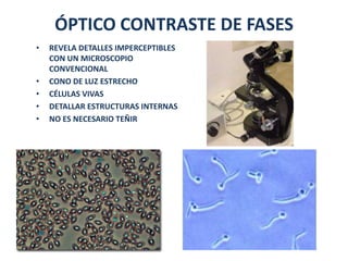 ÓPTICO CONTRASTE DE FASES
•   REVELA DETALLES IMPERCEPTIBLES
    CON UN MICROSCOPIO
    CONVENCIONAL
•   CONO DE LUZ ESTRECHO
•   CÉLULAS VIVAS
•   DETALLAR ESTRUCTURAS INTERNAS
•   NO ES NECESARIO TEÑIR
 