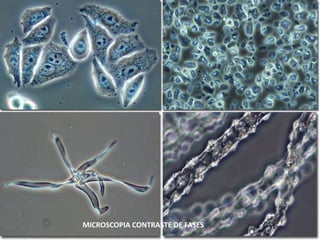 MICROSCOPIA CONTRASTE DE FASES
 