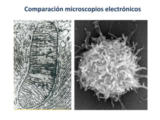 Comparación microscopios electrónicos
 