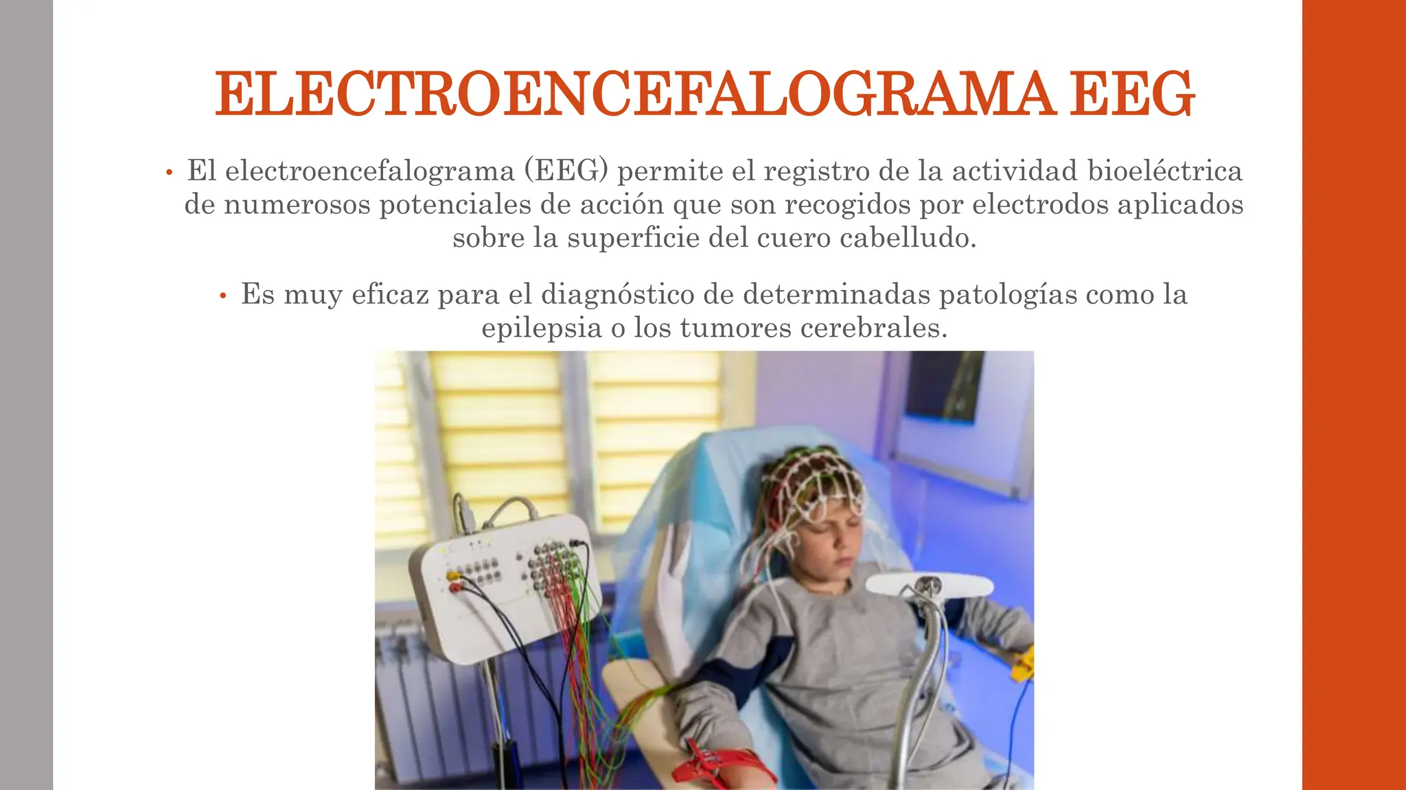 ELECTROENCEFALOGRAMA EEG
• El electroencefalograma (EEG) permite el registro de la actividad bioeléctrica
de numerosos potenciales de acción que son recogidos por electrodos aplicados
sobre la superficie del cuero cabelludo.
• Es muy eficaz para el diagnóstico de determinadas patologías como la
epilepsia o los tumores cerebrales.
 