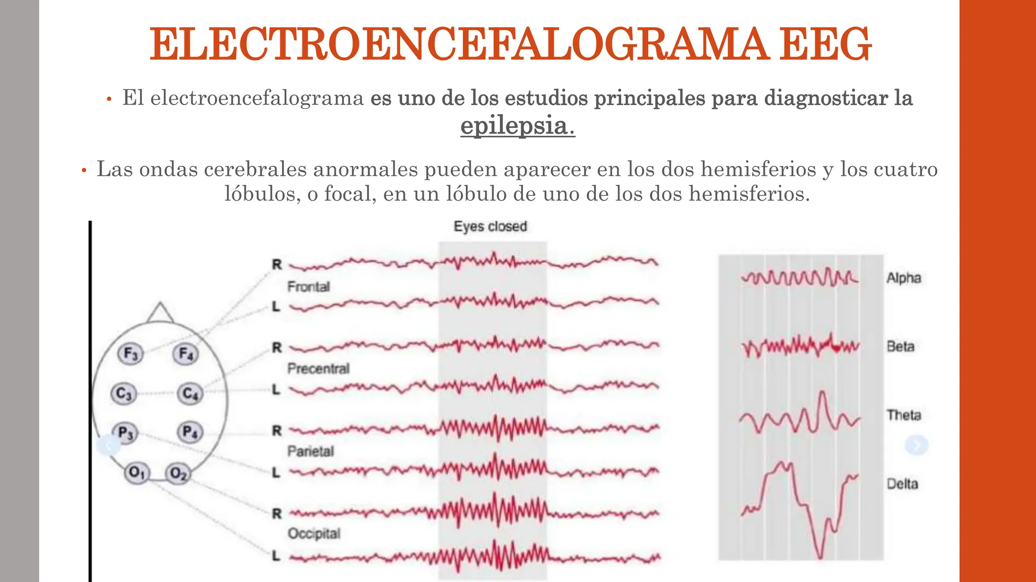 • El electroencefalograma es uno de los estudios principales para diagnosticar la
epilepsia.
• Las ondas cerebrales anormales pueden aparecer en los dos hemisferios y los cuatro
lóbulos, o focal, en un lóbulo de uno de los dos hemisferios.
ELECTROENCEFALOGRAMA EEG
 