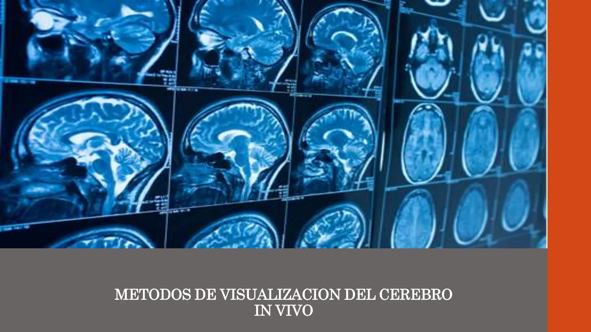 METODOS DE VISUALIZACION DEL CEREBRO
IN VIVO
 