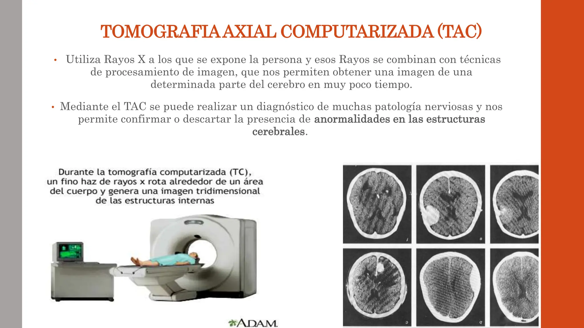 TOMOGRAFIAAXIAL COMPUTARIZADA (TAC)
• Utiliza Rayos X a los que se expone la persona y esos Rayos se combinan con técnicas
de procesamiento de imagen, que nos permiten obtener una imagen de una
determinada parte del cerebro en muy poco tiempo.
• Mediante el TAC se puede realizar un diagnóstico de muchas patología nerviosas y nos
permite confirmar o descartar la presencia de anormalidades en las estructuras
cerebrales.
 