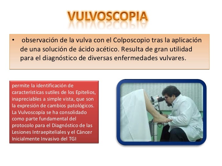 Vulvoscopia