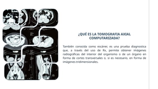 ¿QUÉ ES LA TOMOGRAFIA AXIAL
COMPUTARIZADA?
También conocida como escáner, es una prueba diagnostica
que, a través del uso de Rx, permite obtener imágenes
radiográficas del interior del organismo o de un órgano en
forma de cortes transversales o, si es necesario, en forma de
imágenes tridimensionales.
 