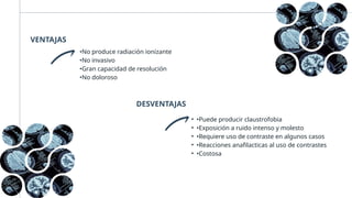 VENTAJAS
•No produce radiación ionizante
•No invasivo
•Gran capacidad de resolución
•No doloroso
DESVENTAJAS
• •Puede producir claustrofobia
• •Exposición a ruido intenso y molesto
• •Requiere uso de contraste en algunos casos
• •Reacciones anafilacticas al uso de contrastes
• •Costosa
 