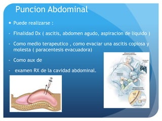 Puncion Abdominal
 Puede realizarse :
- Finalidad Dx ( ascitis, abdomen agudo, aspiracion de liquido )
- Como medio terapeutico , como evaciar una ascitis copiosa y
molesta ( paracentesis evacuadora)
- Como aux de
- examen RX de la cavidad abdominal.

 
