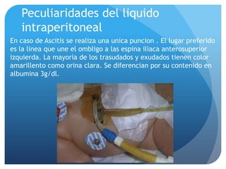 Peculiaridades del liquido
intraperitoneal
En caso de Ascitis se realiza una unica puncion . El lugar preferido
es la linea que une el ombligo a las espina iliaca anterosuperior
izquierda. La mayoria de los trasudados y exudados tienen color
amarillento como orina clara. Se diferencian por su contenido en
albumina 3g/dl.

 