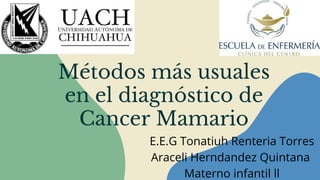 Métodos más usuales
en el diagnóstico de
Cancer Mamario
E.E.G Tonatiuh Renteria Torres
Araceli Herndandez Quintana
Materno infantil ll
 