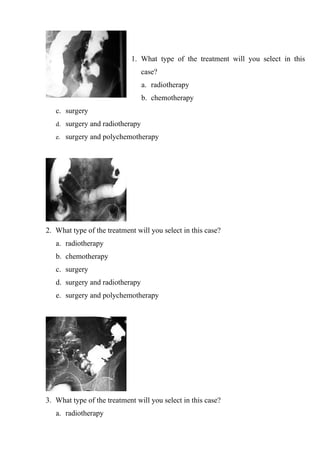 1. What type of the treatment will you select in this
                                 case?
                                 a. radiotherapy
                                 b. chemotherapy
   c. surgery
   d. surgery and radiotherapy

   e. surgery and polychemotherapy




2. What type of the treatment will you select in this case?
   a. radiotherapy
   b. chemotherapy
   c. surgery
   d. surgery and radiotherapy
   e. surgery and polychemotherapy




3. What type of the treatment will you select in this case?
   a. radiotherapy
 
