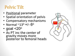 Normal Tilt Reposition Metrics in spinal deformity | PPTX