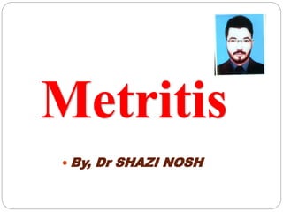 Metritis
 By, Dr SHAZI NOSH
 