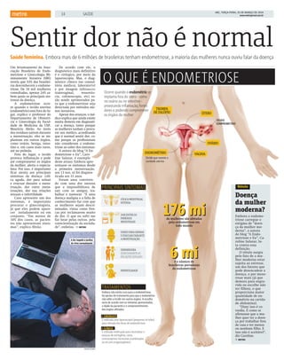 Um levantamento da Asso-
ciação Brasileira de Endo-
metriose e Ginecologia Mi-
nimamente Invasiva (SBE)
revela que 53% das brasilei-
ras desconhecem a endome-
triose. De 10 mil mulheres
consultadas, apenas 24% sa-
bem quais os principais sin-
tomas da doença.
A endometriose ocor-
re quando o tecido uterino
(endométrio) está fora do lu-
gar, explica o professor do
Departamento de Obstetrí-
cia e Ginecologia da Facul-
dade de Medicina da USP,
Maurício Abrão. Ao invés
dos resíduos saírem durante
a menstruação, eles se im-
plantam em outros órgãos,
como ovário, bexiga, intes-
tino e, em casos mais raros,
até no pulmão.
Fora do lugar, o tecido
provoca inflamação e pode
até comprometer os órgãos
da mulher, alerta o especia-
lista. Por isso, é importante
ficar atenta aos principais
sintomas da doença: cóli-
ca aguda, dor para urinar
e evacuar durante a mens-
truação, dor entre mens-
truações, dor nas relações
sexuais e infertilidade.
Caso apresente um dos
sintomas, é importante
procurar o ginecologista,
já que eles podem apare-
cer isoladamente ou em
conjunto. “Em menos de
10% dos casos, as pacien-
tes não apresentam sinto-
mas”, explica Abrão.
De acordo com ele, o
diagnóstico mais definitivo
é o cirúrgico, por meio da
laparoscopia. Mas, o diag-
nóstico clínico (no consul-
tório médico), laboratorial
e por imagem (ultrassom
transvaginal, ressonân-
cia, colonoscopia, etc) es-
tão sendo aprimorados pa-
ra que a endometriose seja
detectada por métodos me-
nos invasivos.
Apesar dos avanços, o mé-
dico explica que ainda existe
muita demora em diagnosti-
car a doença, tanto porque
as mulheres tardam a procu-
rar um médico, acreditando
que é normal sentir dor, co-
mo porque os profissionais
não consideram a endome-
triose ao saber dos sintomas.
A autora do blog “A En-
dometriose e Eu”, Caro-
line Salazar, é exemplo
deste atraso. Embora apre-
sentasse os sintomas desde
a primeira menstruação,
aos 13 nos, só foi diagnos-
ticada aos 31 anos.
Foram anos conviven-
do com uma dor intensa
que a impossibilitava de
sair com os amigos, tra-
balhar e namorar. “É uma
doença maligna e a falta de
conhecimento faz com que
as mulheres sejam descri-
minadas, vistas como fres-
cas por reclamarem muito
de dor. O que eu sofri me
faz lutar pelas outras, pela
conscientização da socieda-
de”, enfatiza. METRO
Saúde feminina. Embora mais de 6 milhões de brasileiras tenham endometriose, a maioria das mulheres nunca ouviu falar da doença
Sentir dor não é normal
A dor impede a mulher
de viver normalmente
STOCK XCHNG
271.125 mm
Embora não exista cura para a endometriose,
há opcões de tratamento para que o endométrio
não volte a incidir em outros órgãos. A escolha
varia de acordo com os sintomas apresentados,
a idade da paciente e o comprometimento
dos órgãos afetados:
CIRÚRGICO
É realizada uma laparoscopia (pequenas incisões)
para retirada dos focos de endometriose
CLÍNICO
É utilizada medicação para neutralizar o
excesso de estrogênio, como
contraceptivos hormonais (combinados
ou só com progestogênios)
CÓLICAMENSTRUAL
INTENSA
DORENTREOS
PERÍODOS
MENSTRUAIS
DORESPARAURINAR
EEVACUARDURANTE
AMENSTRUAÇÃO
DISPAREUNIA
(DORDURANTEAS
RELAÇÕESSEXUAIS)
INFERTILIDADE
PRINCIPAIS SINTOMAS
TRATAMENTOS
176 mi
6 mi6 mié o número de
brasileiras portadoras
de endometriose
176 mide mulheres são afetadas
pela endometriose em
todo mundo
TROMPA
DEFALÓPIO ÚTERO
OVÁRIO
VAGINAENDROMÉTRIO
Ocorre quando o endométrio se
implanta fora do útero - como
no ovário ou no intestino -
provocando inﬂamação, fortes
dores e podendo comprometer
os órgãos da mulher
Tecido que reveste a
cavidade uterina
O QUE É ENDOMETRIOSE
TECIDO
COMPROMETIDO
Doença
da mulher
moderna?
Embora a endome-
triose carregue o
estigma de “doen-
ça da mulher mo-
derna”, a autora
do blog “A Endo-
metriose e Eu”, Ca-
roline Salazar, lu-
ta contra essa
definição.
O rótulo surgiu
pelo fato de a mu-
lher moderna estar
sujeita ao estresse,
um dos fatores que
pode desencadear a
doença, e por mens-
truar mais (já que
demora para engra-
vida ou escolhe não
ter filhos), o que
proporciona maior
quantidade de en-
dométrio na cavida-
de abdominal.
“Dizer isso é co-
vardia. É como se
afirmasse que a mu-
lher quer ter a doen-
ça por trabalhar fora
de casa e ter menos
ou nenhum filho. E
isso não é aceitável”,
diz Caroline.
METRO
Rótulo
ABC, TERÇA-FEIRA, 25 DE MARÇO DE 2014
www.metrojornal.com.br|14| {SAÚDE 
 