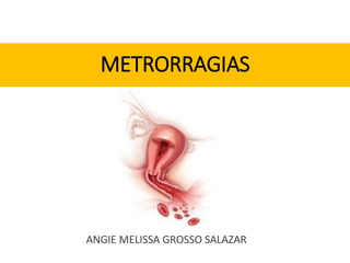 METRORRAGIAS
ANGIE MELISSA GROSSO SALAZAR
 