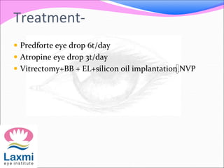 Treatment-
 Predforte eye drop 6t/day
 Atropine eye drop 3t/day
 Vitrectomy+BB + EL+silicon oil implantation NVP
 