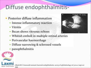 Diffuse endophthalmitis-
 Posterior diffuse inflammation
 Intense inflammatory reaction
 Vitritis
 Bscan shows vitreous echoes
 Whitish emboli in multiple retinal arteries
 Perivascular haemorrhage
 Diffuse narrowing & sclerosed vessels
 panophthalmitis
J Mark,M.D. Greenwald metstatic bacterial endophthalmitis: survey of ophthalmology vol 31:no.2/;sept-oct
1999
 