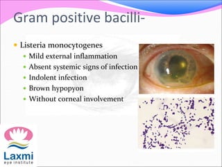 Gram positive bacilli-
 Listeria monocytogenes
 Mild external inflammation
 Absent systemic signs of infection
 Indolent infection
 Brown hypopyon
 Without corneal involvement
 